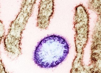 Nipah is a Zoonotic disease, animals are its carriers, especially the fruit bats