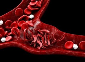 Blood safety concern raised in Parliament